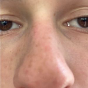 Meet your Posher, Nolan